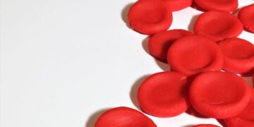 Stem Cell Myelofibrosis Overview and Definition