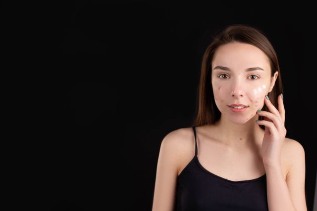 Chemical Peel for Bacne Does It Work