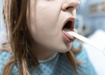 Bumps on the Back of My Tongue What They Mean