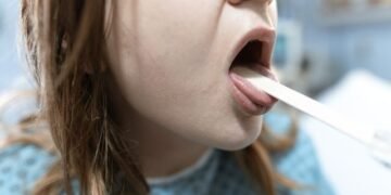 Bumps on the Back of My Tongue What They Mean