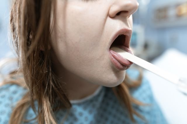 Bumps on the Back of My Tongue What They Mean