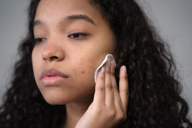 Can Ashwagandha Cause Acne What the Evidence Says