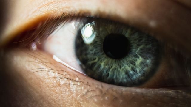 Central Heterochromia vs. Hazel How to Tell