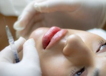 How Much Is Half a Syringe of Lip Filler