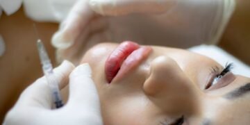 How Much Is Half a Syringe of Lip Filler