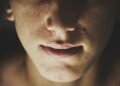 How to Tell if Your Nose Is Broken