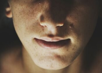 How to Tell if Your Nose Is Broken