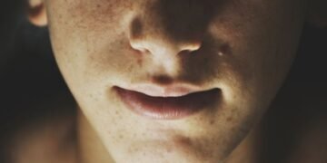 How to Tell if Your Nose Is Broken
