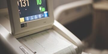 What Does Borderline ECG Mean A Clear Guide