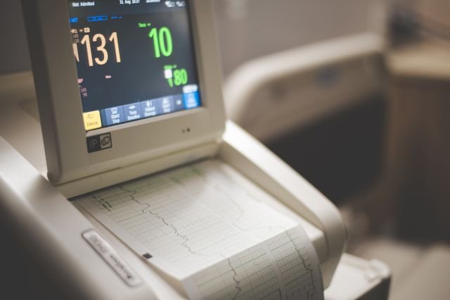 What Does Borderline ECG Mean A Clear Guide