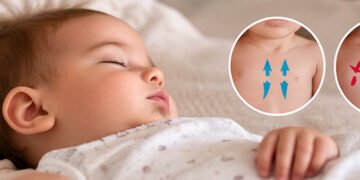 Normal Baby Breathing vs Retractions Know the Signs