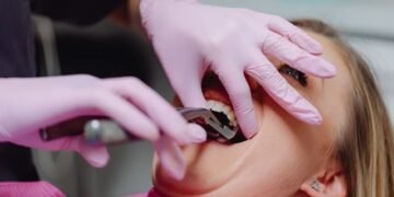 When Can I Use a Straw After Tooth Extraction