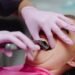 When Can I Use a Straw After Tooth Extraction