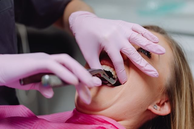 When Can I Use a Straw After Tooth Extraction