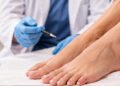 foot-feminization-surgery